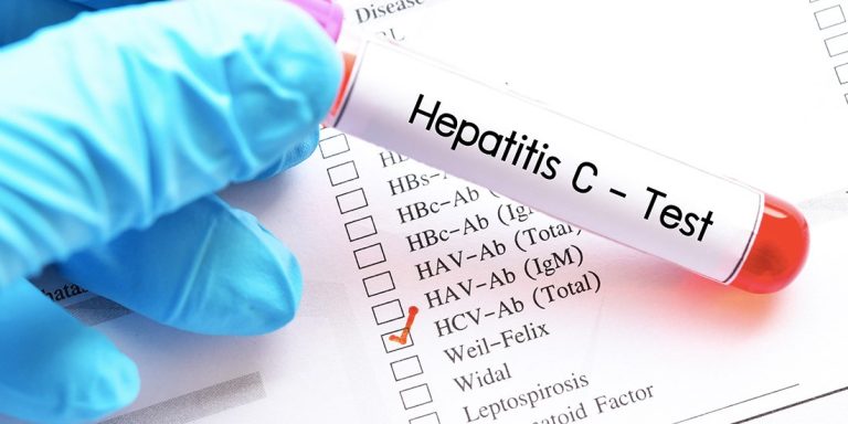 hepatitis-C-test-4