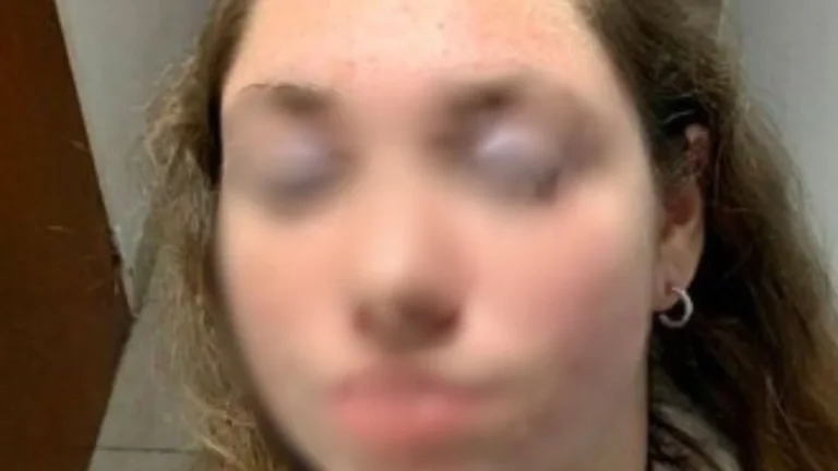 720