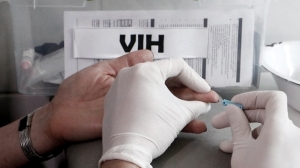 La tasa de nuevos diagnósticos de VIH bajó 35% en los últimos cinco años en la Argentina