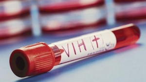 En 2021 en La Rioja se detectaron 132 casos de HIV